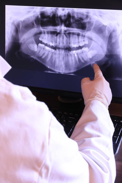 Best Emergency Wisdom Teeth Removal in Weston, WI
